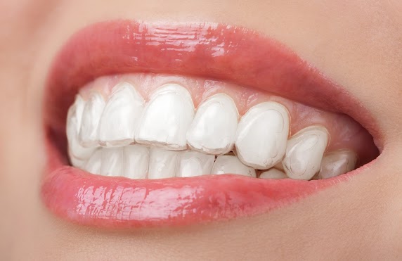 Sandton Invisalign Care